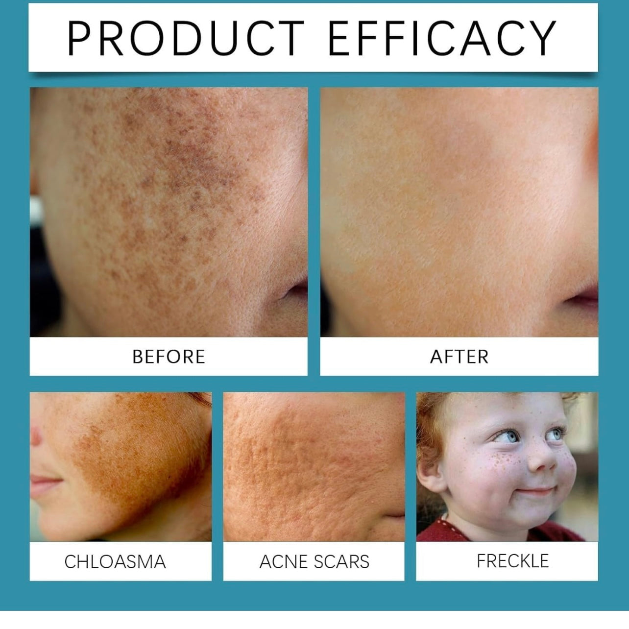Non-Invasive Mole and
Wart Removal Laser Pen in just 2499